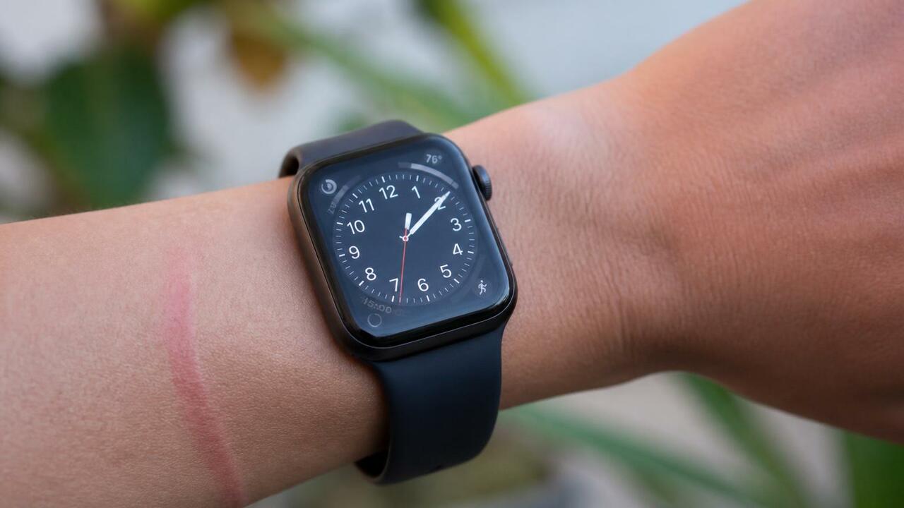 Владельцы Samsung Galaxy Watch сообщают о красн...