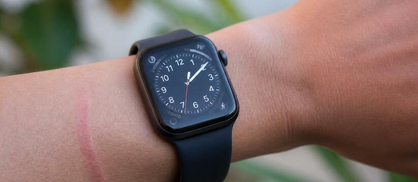 Владельцы Galaxy Watch жалуются на следы на зап...