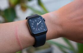 Владельцы Galaxy Watch жалуются на следы на зап...